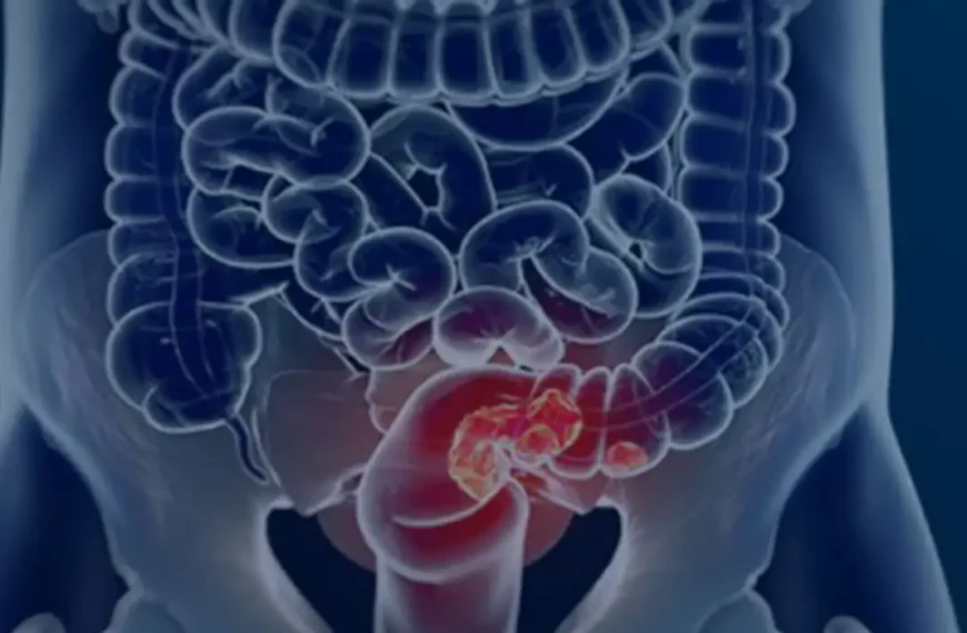 Estudo projeta aumento de 36%&hellip;