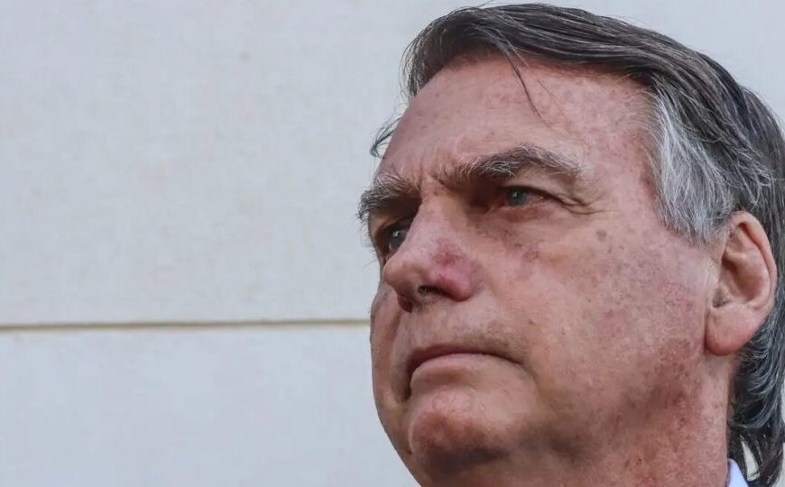 Carlos Bolsonaro afirma que saúde de Jair Bolsonaro está mais debilitada