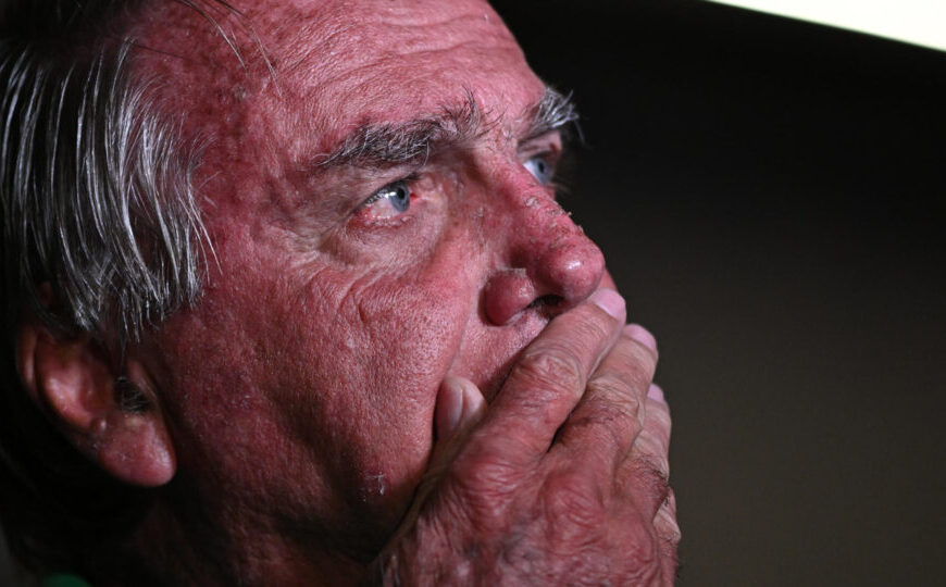 Bolsonaro teve crise de soluço, vômito e falta&hellip;