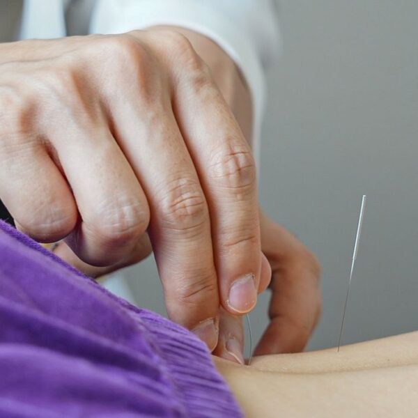 Brasil regulamenta exercício profissional da acupuntura
