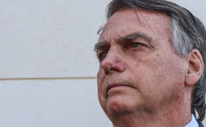 Estímulo Elétrico Craniano: Entenda o tratamento solicitado pela&hellip;