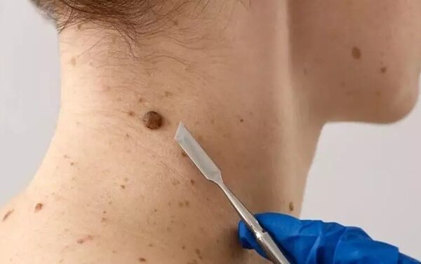 Mutirão com médicos especialistas atende quase 100 pacientes&hellip;