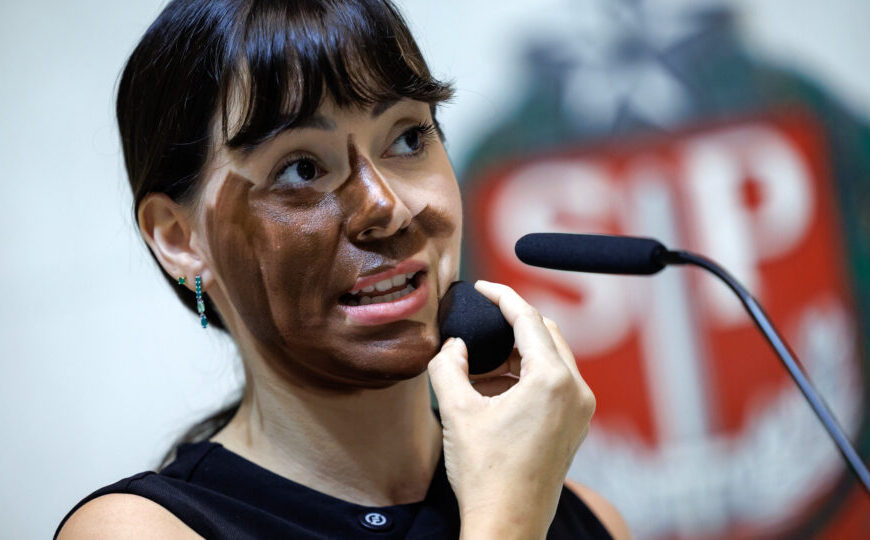 MP pede arquivamento de acusação de racismo contra Fabiana Bolsonaro por “blackface”